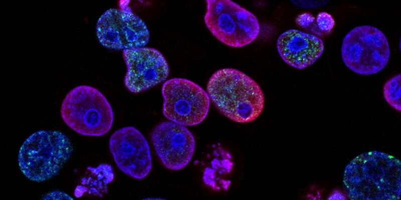Human colorectal cancer cells treated with a topoisomerase inhibitor and an inhibitor of the protein kinase ATR (ataxia telangiectasia and Rad3 related), a drug combination under study as a cancer therapy. Cell nuclei are stained blue; the chromosomal protein histone gamma-H2AX marks DNA damage in red and foci of DNA replication in green.  Created by Yves Pommier, Rozenn Josse, 2014. Photo by National Cancer Institute, Unsplash.